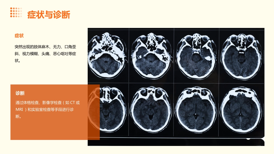 脑卒中病人的护理ppt课件_第6页
