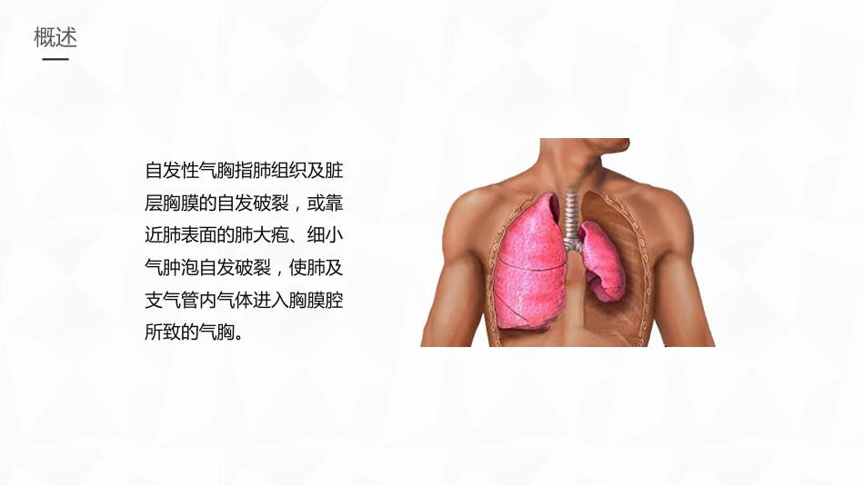 重症护理：结核性胸膜炎患者自发性气胸护理_第4页