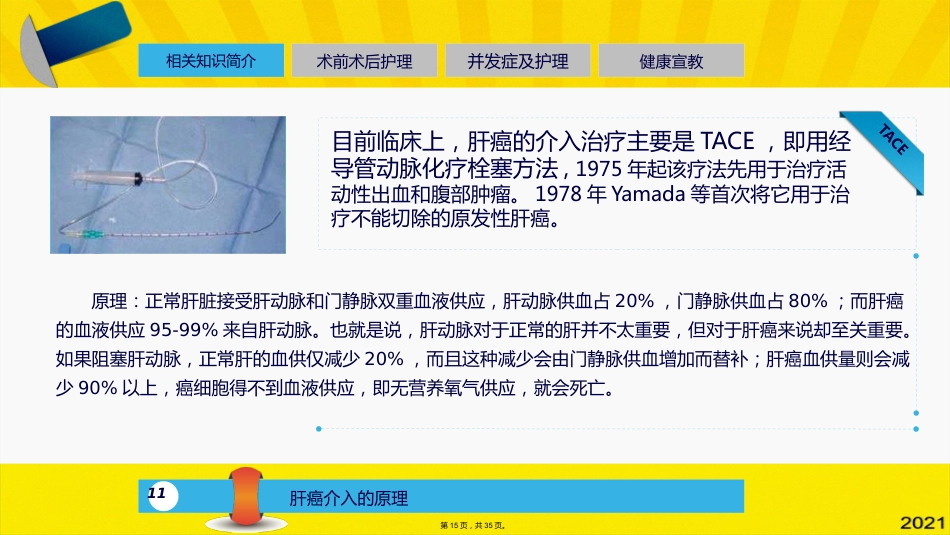 肝癌介入的治疗与护理_第14页