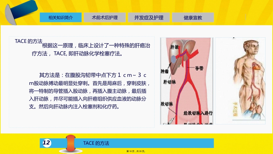 肝癌介入的治疗与护理_第15页