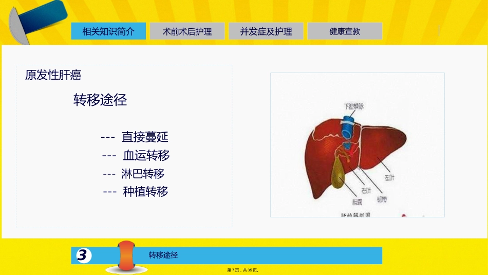 肝癌介入的治疗与护理_第6页