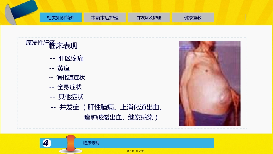 肝癌介入的治疗与护理_第7页