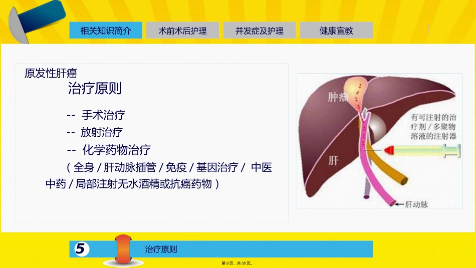 肝癌介入的治疗与护理_第8页