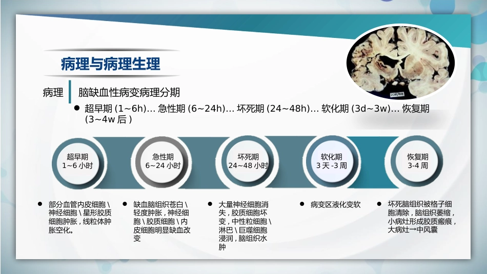 脑梗死腔隙性梗死护理查房PPT课件_第11页