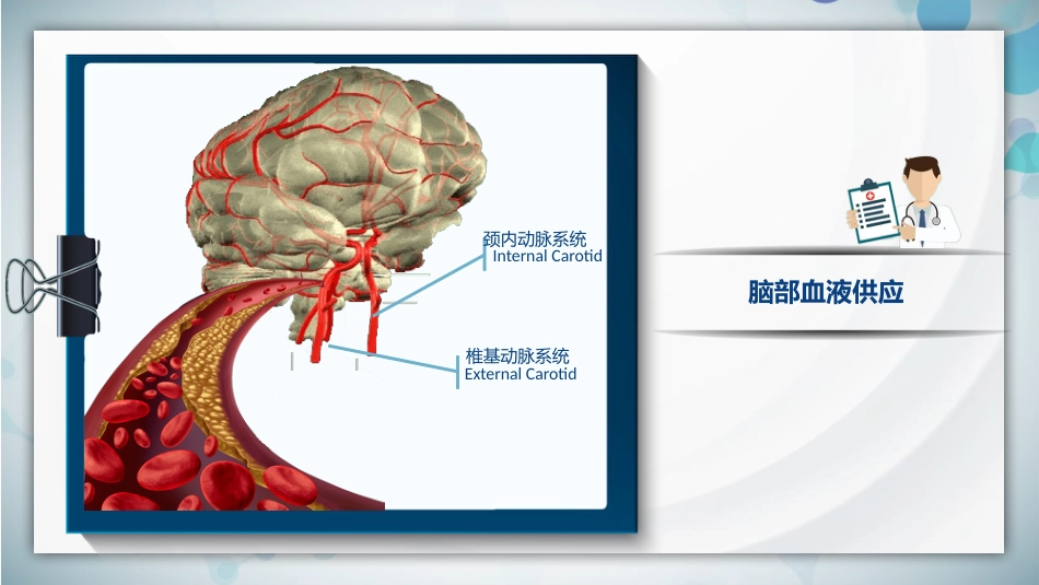 脑梗死腔隙性梗死护理查房PPT课件_第5页