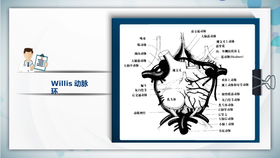 脑梗死腔隙性梗死护理查房PPT课件_第6页