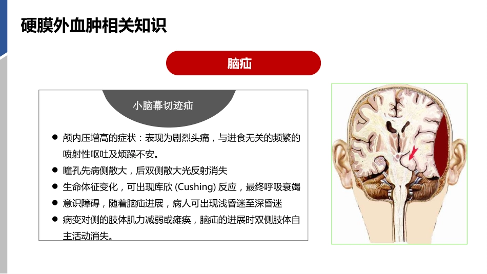 硬膜外血肿护理查房_第10页