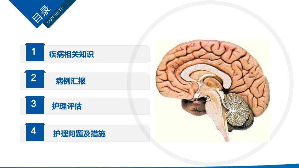 硬膜外血肿护理查房_第2页