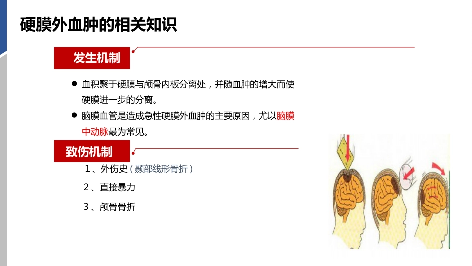硬膜外血肿护理查房_第7页