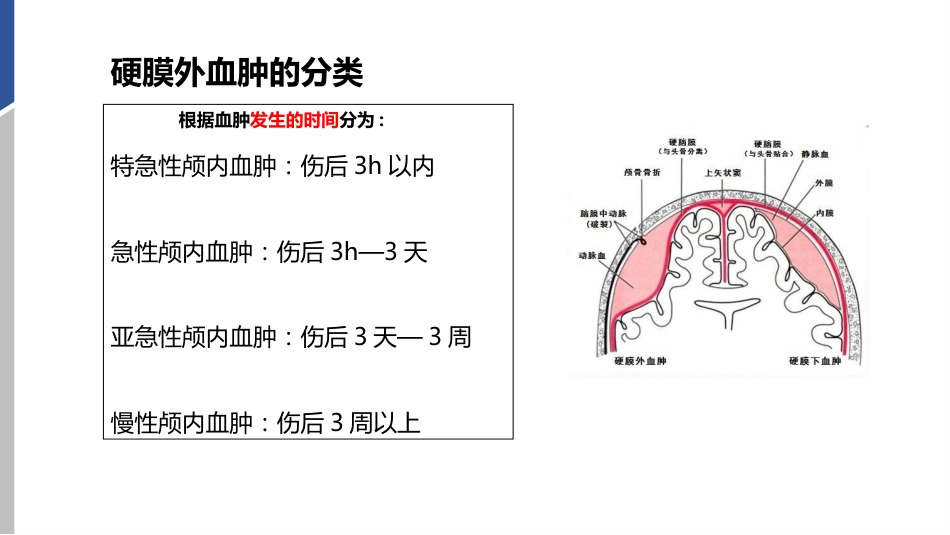 硬膜外血肿护理查房_第8页