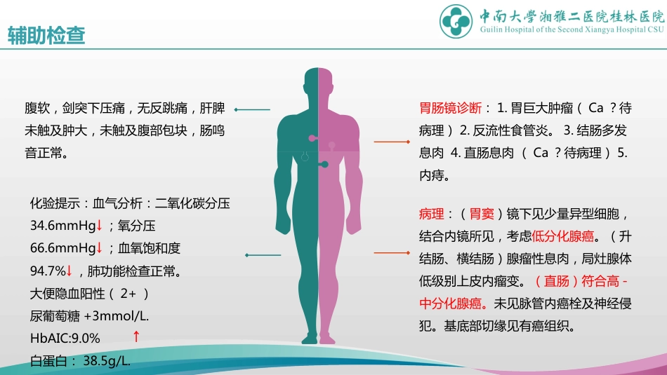 一例胃癌患者的疑难病例讨论_第15页