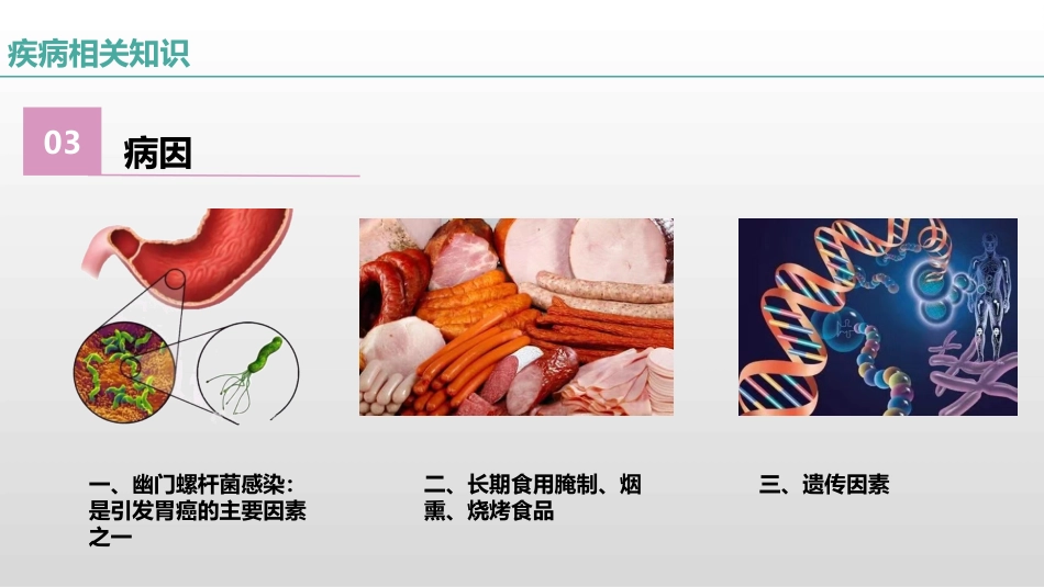 一例胃癌患者的疑难病例讨论_第6页