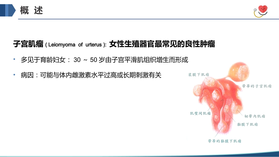 子宫肌瘤手术期护理_第4页