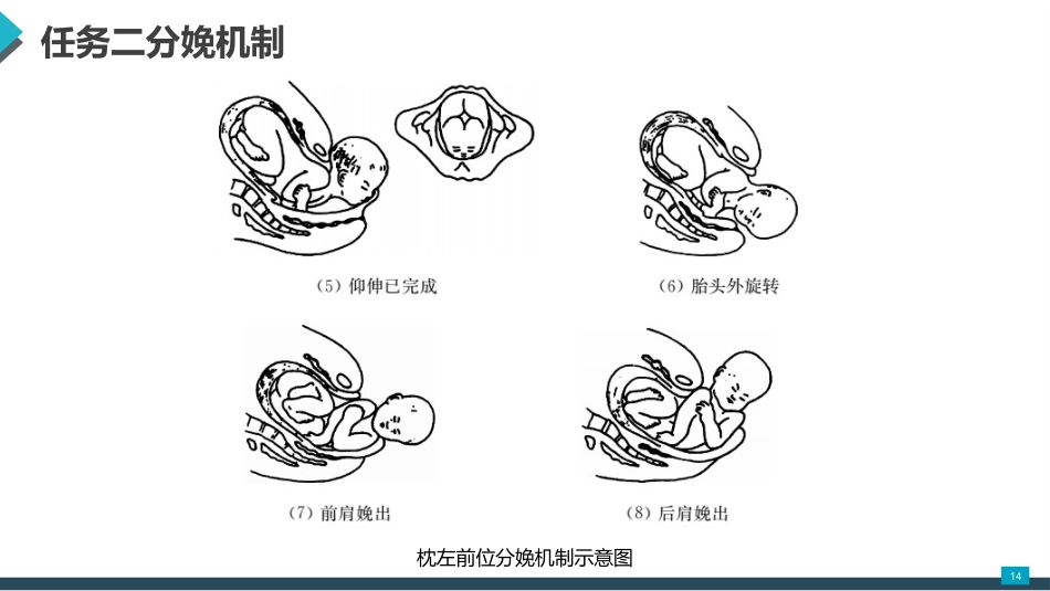 母婴护理课件：正常分娩期妇女的护理_第14页