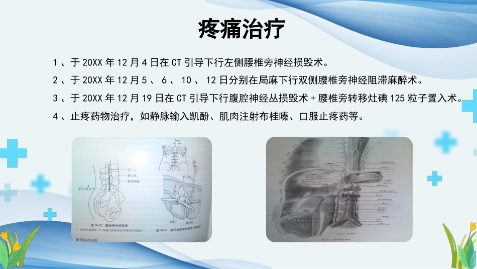 卵巢癌个案护理课件ppt_第15页