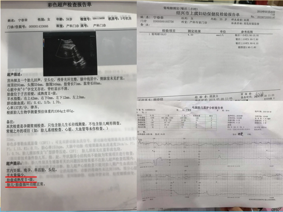 产科VTE护理查房_第8页
