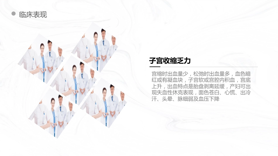 妇产护理：产后出血护理查房_第8页