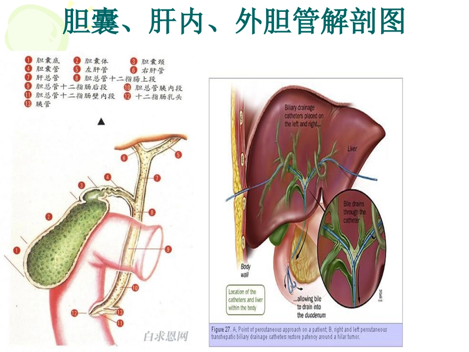 恶性梗阻性黄疸介入治疗及护理_第7页