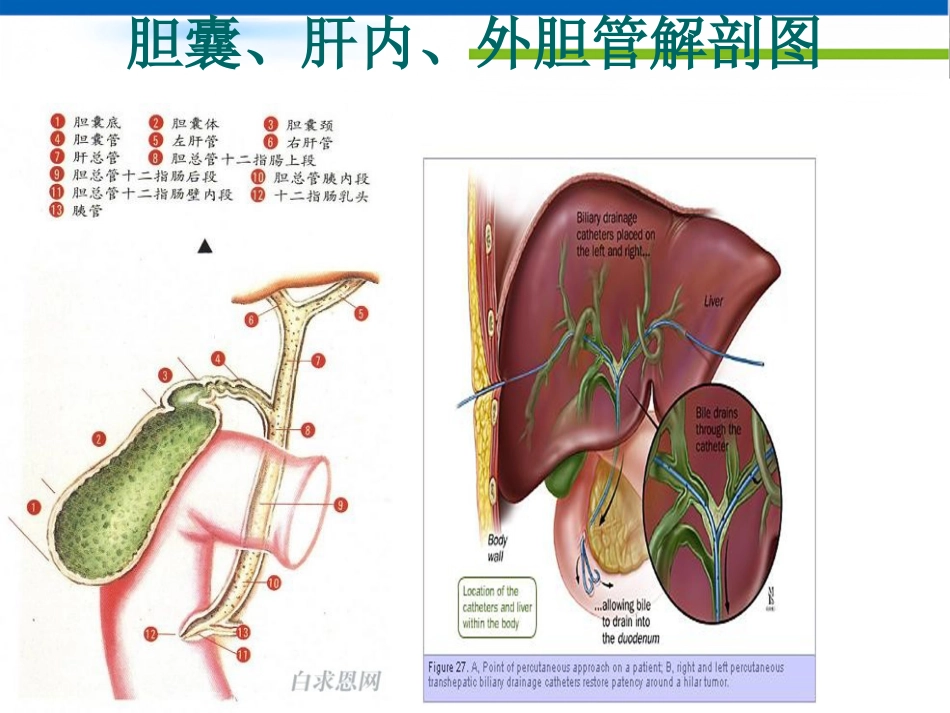恶性梗阻性黄疸介入治疗及护理 (2)_第6页