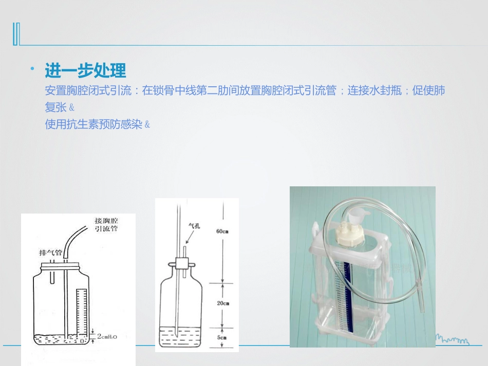 创伤性血气胸的急救与护理_第14页
