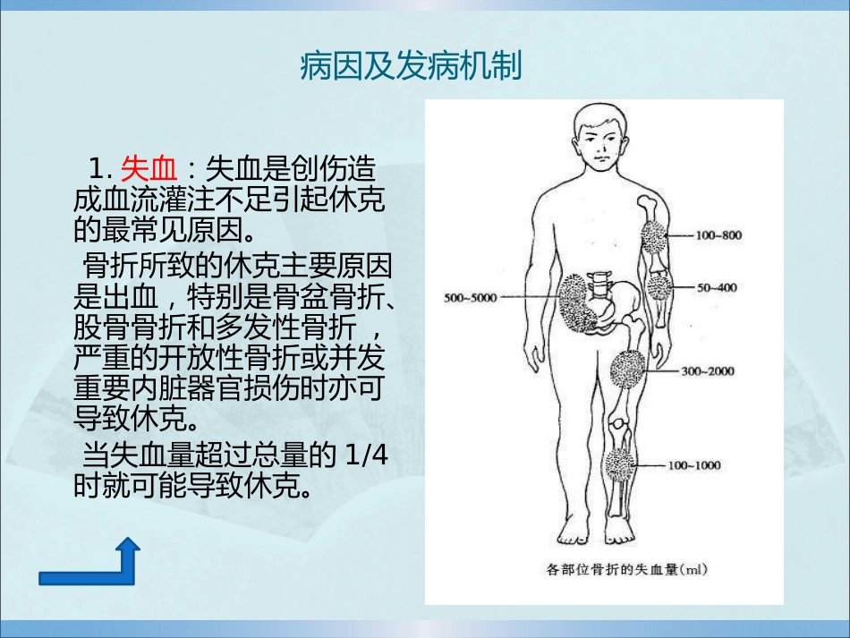 创伤性休克的急救护理_第15页