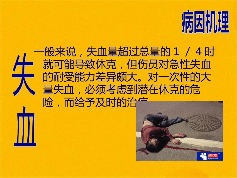 创伤性休克的急救护理(1)_第10页