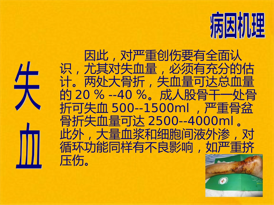 创伤性休克的急救护理(1)_第9页