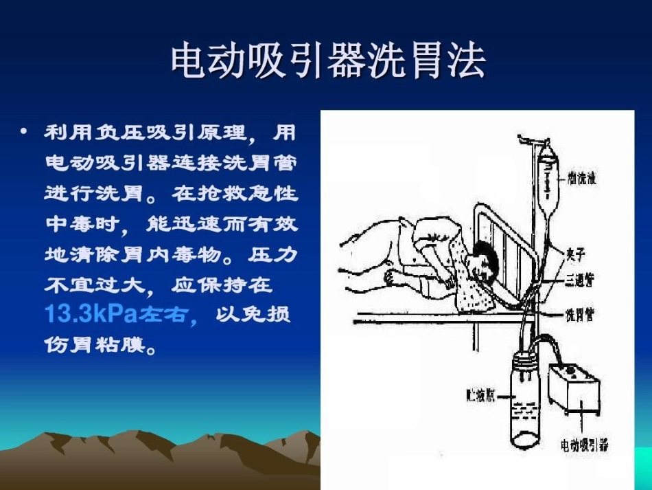洗胃法操作并发症及预防_第10页