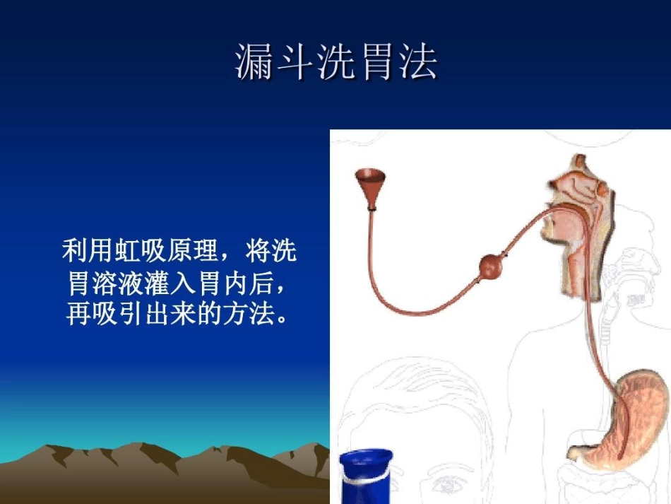 洗胃法操作并发症及预防_第9页