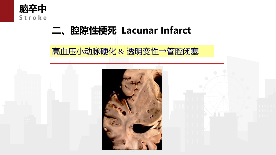 脑卒中病人的急救与护理 (2)_第11页