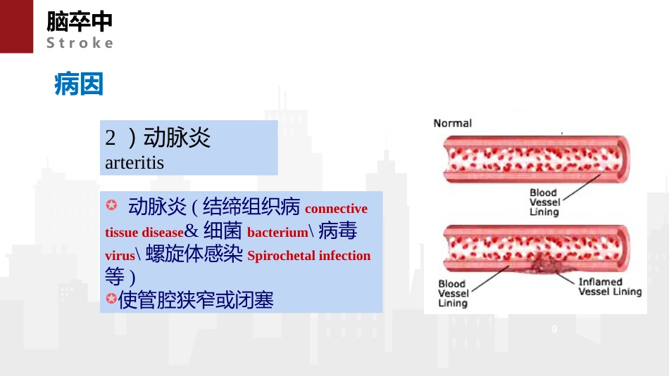 脑卒中病人的急救与护理 (2)_第9页