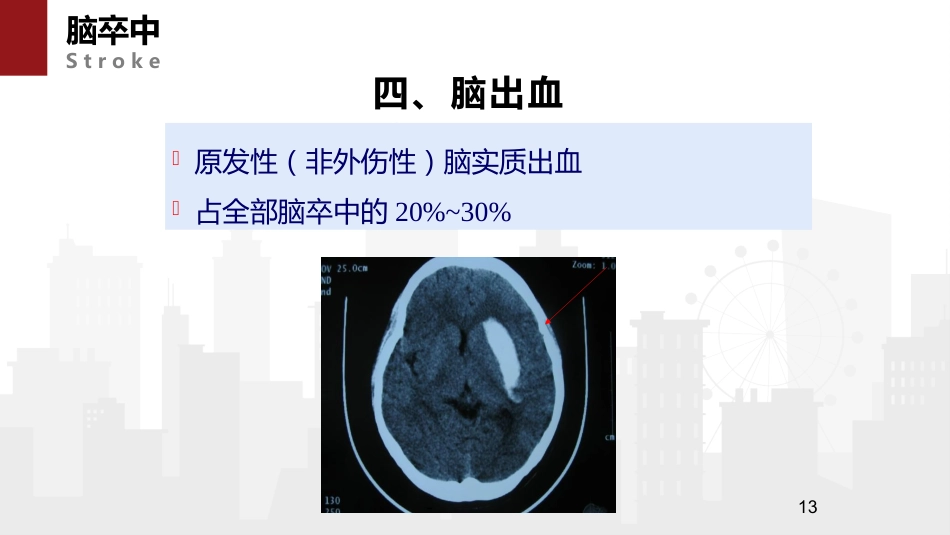 脑卒中病人的急救与护理_第13页
