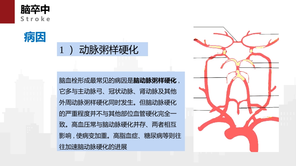 脑卒中病人的急救与护理_第8页