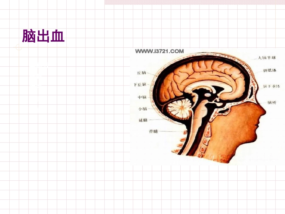 脑出血急救护理_第13页