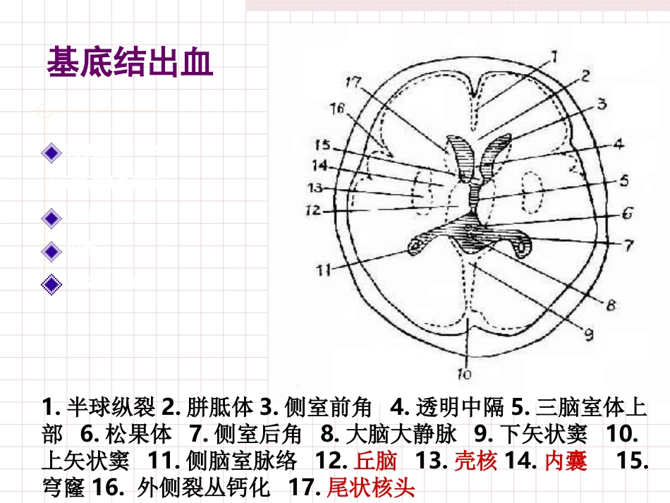 脑出血急救护理_第14页