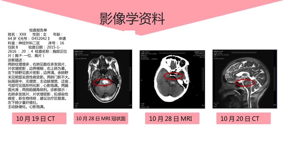 脑出血个案护理案例_第12页
