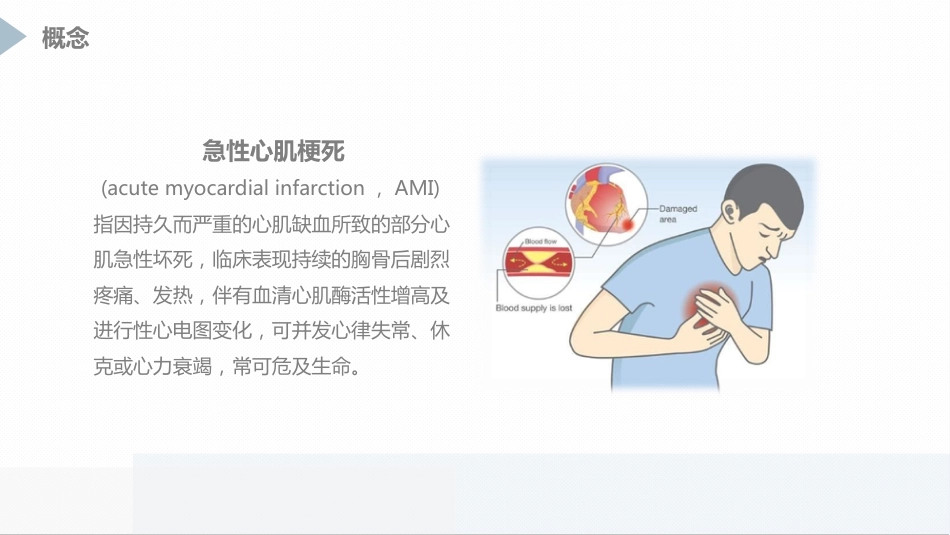 急性心肌梗死患者pci术后护理_第4页