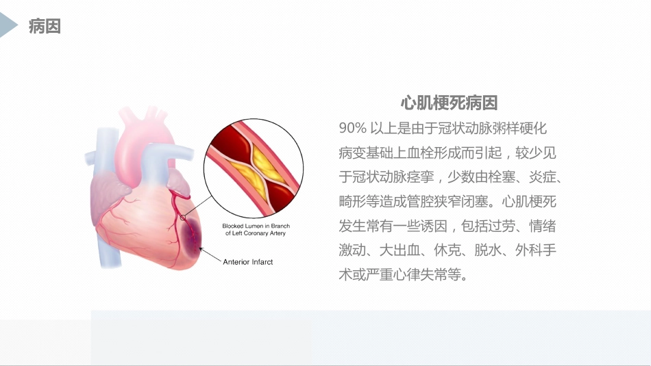 急性心肌梗死患者pci术后护理_第5页