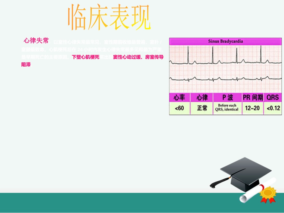 急性心肌梗死的溶栓护理查房_第8页
