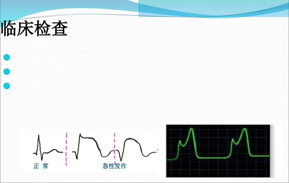 急性心肌梗死的抢救与护理_第12页