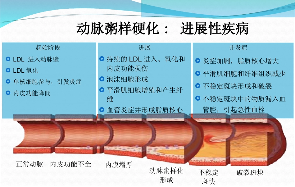 急性心肌梗死的抢救与护理_第2页