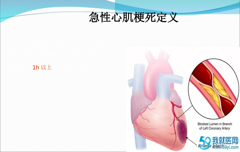 急性心肌梗死的抢救与护理_第4页