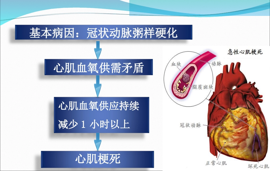 急性心肌梗死的抢救与护理_第5页
