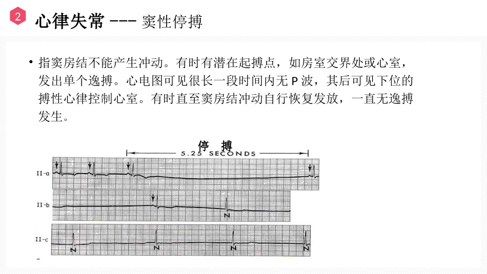 恶性心律失常的识别与护理_第13页