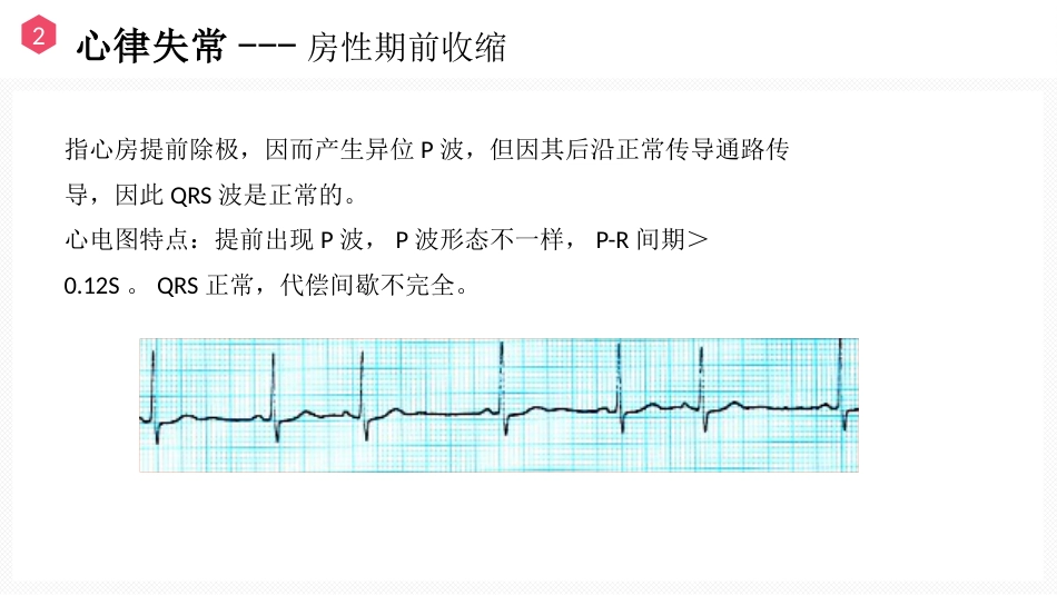 恶性心律失常的识别与护理_第15页