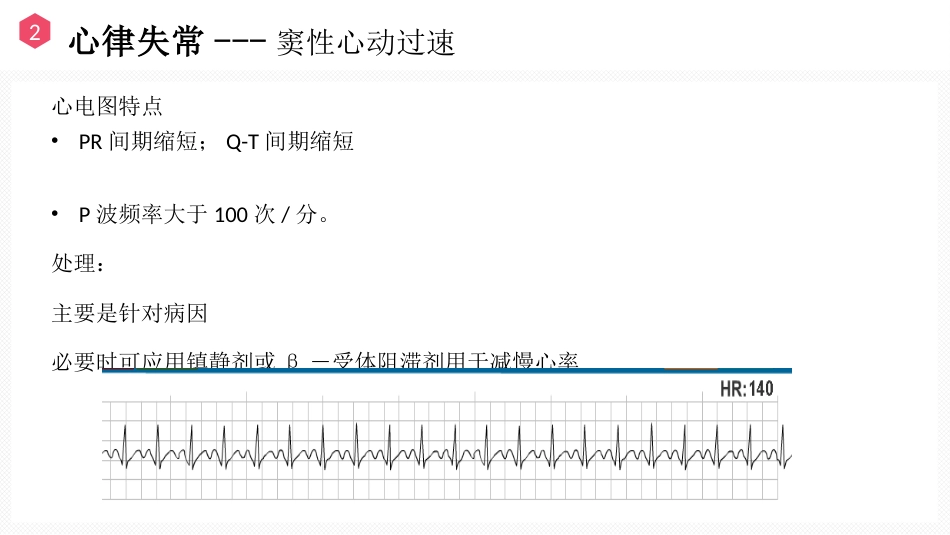 恶性心律失常的识别与护理_第9页