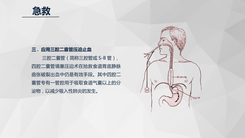 急诊护理：消化道大出血急救与护理知识课件_第13页