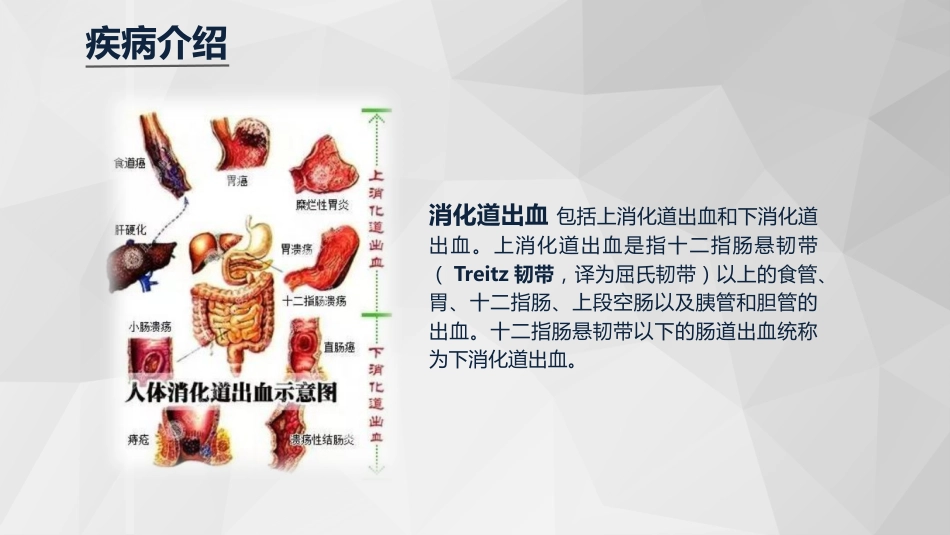 急诊护理：消化道大出血急救与护理知识课件_第4页