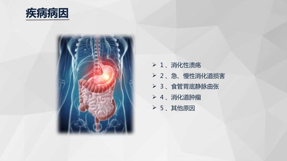 急诊护理：消化道大出血急救与护理知识课件_第6页