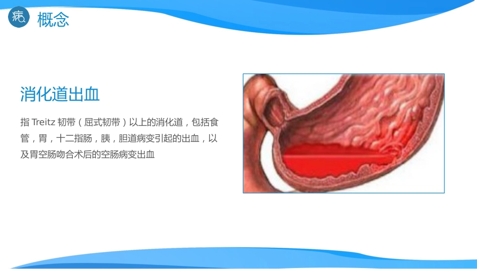 急诊护理：消化道出血医疗_第4页